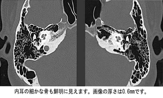 頭部CTの画像