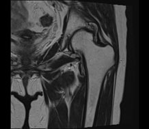 四肢MRI検査の画像
