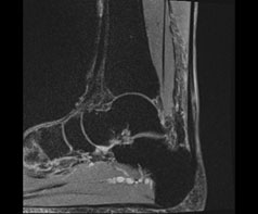 四肢MRI検査の画像